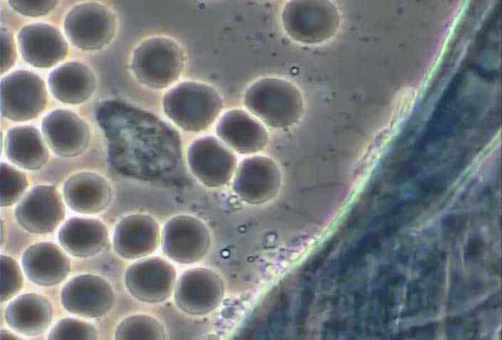 Energetics, Oxygen and Immunity