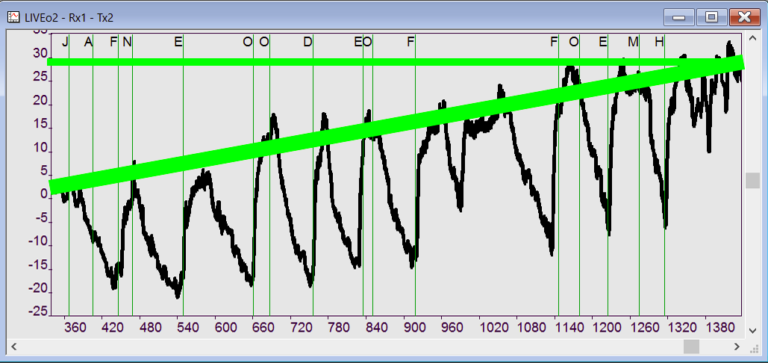 Brain Oxygen Use During LiveO2